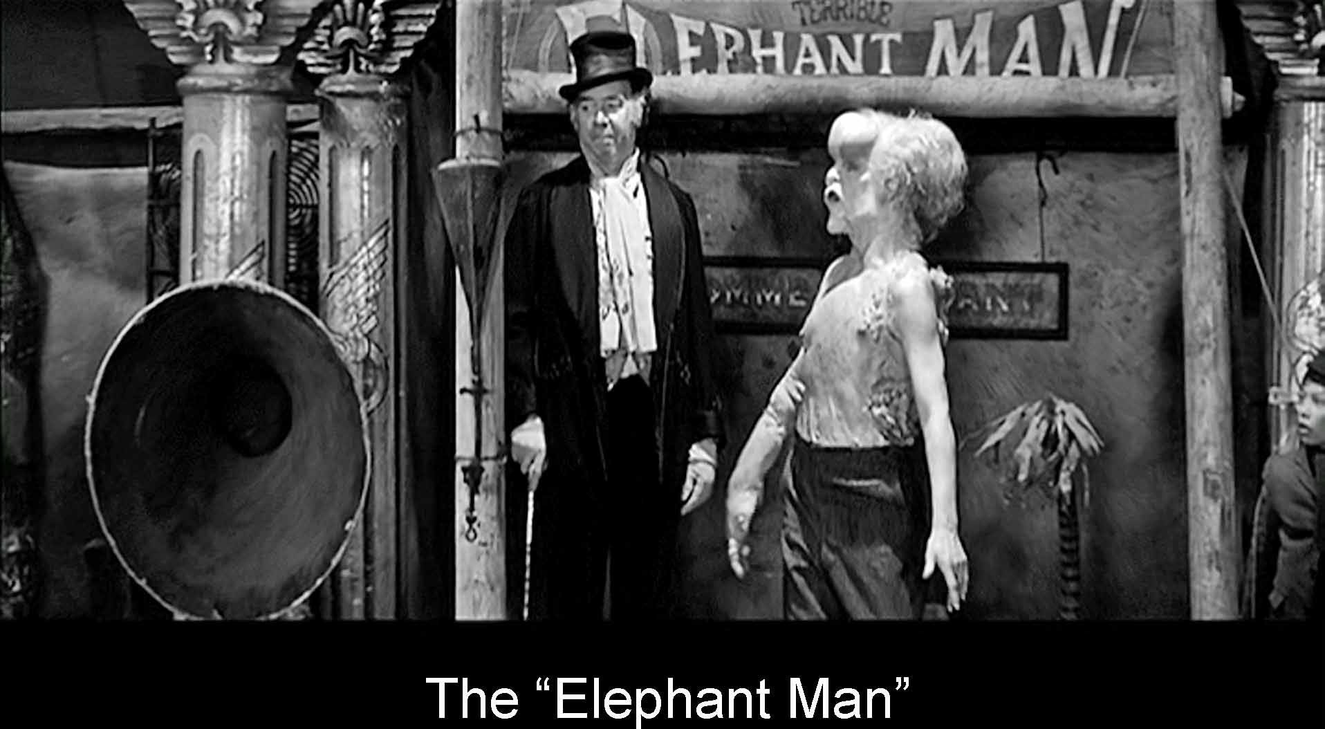  The Elephant Man