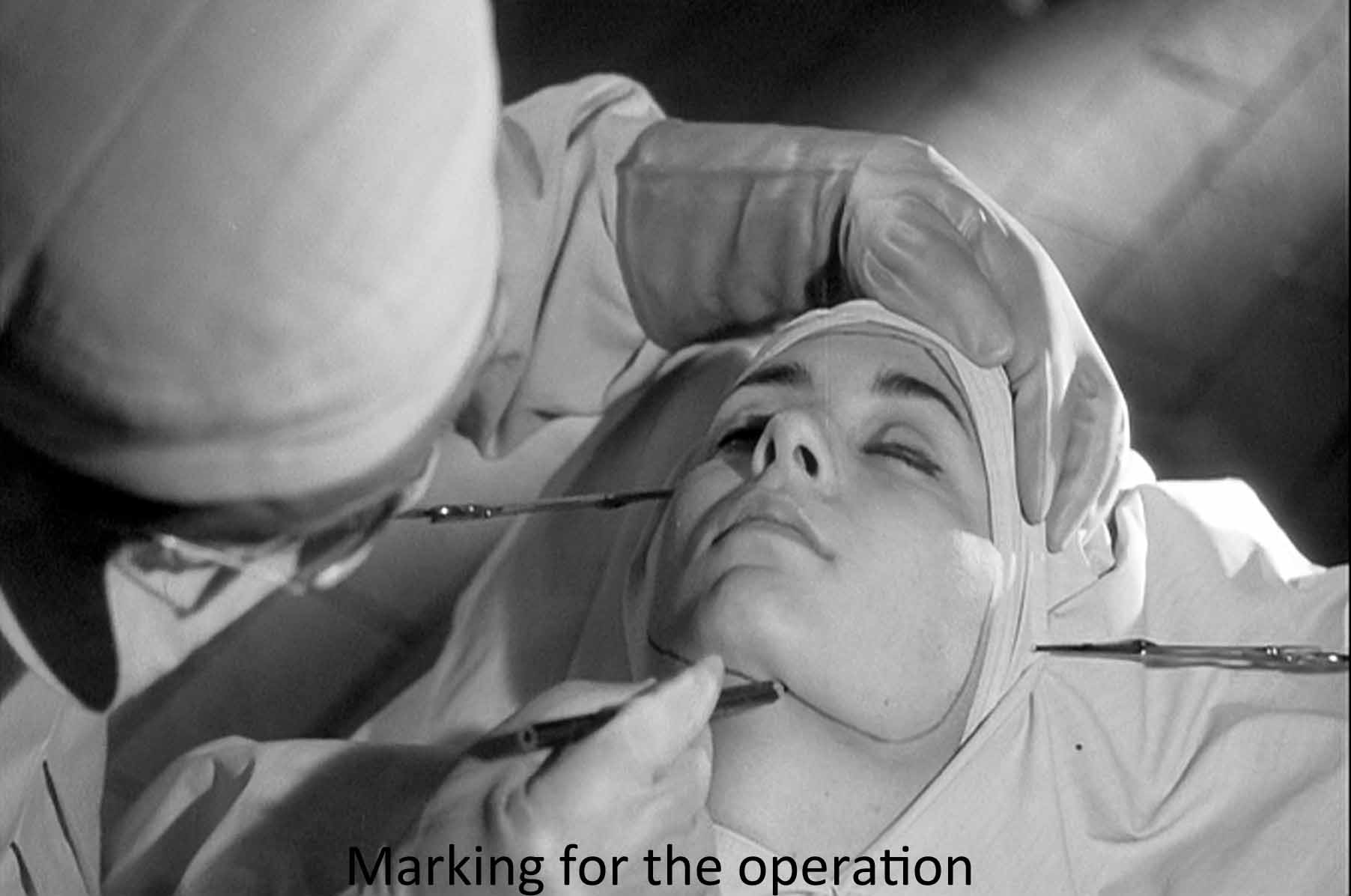 Marking for the operation